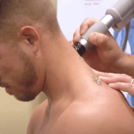Shockwave Treatment for Neck Shockwave Treatment on neck and shoulders